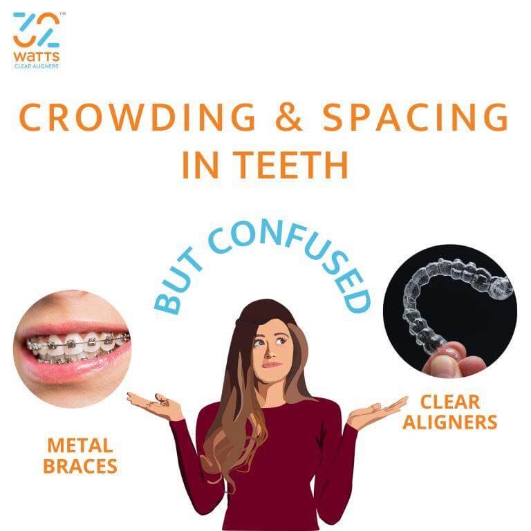 Why Teeth Aligners Or Invisible Braces Are More In Demand Than