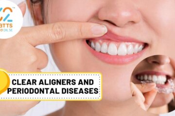 The Best Clear Aligner Brands And Companies 2022 In India