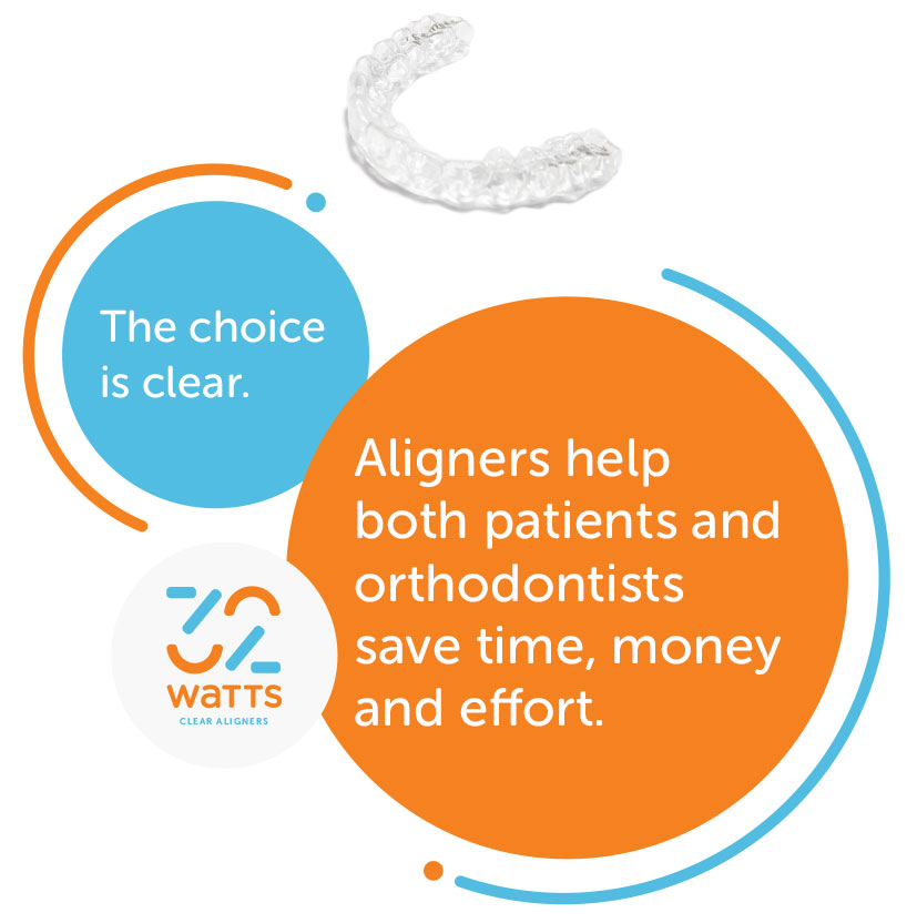 Why choose Aligners?